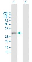 Anti-STX2 Rabbit Polyclonal Antibody