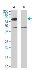 Anti-ZDHHC8 Goat Polyclonal Antibody