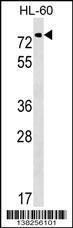 Anti-GALNT9 Rabbit Polyclonal Antibody (AP (Alkaline Phosphatase))