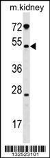 Anti-GALNT13 Rabbit Polyclonal Antibody (AP (Alkaline Phosphatase))