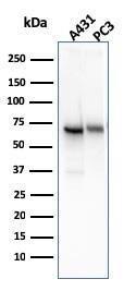 Western blot analysis of A431 and PC-3 cell lysates using Anti-CD73 Antibody [NT5E/2545]