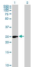 Anti-ERAS Mouse Polyclonal Antibody