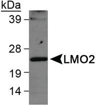 Anti-LMO2 Rabbit Polyclonal Antibody