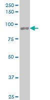 Anti-UBTF Mouse Monoclonal Antibody [clone: 1A2]