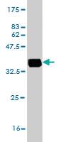 Anti-APOBR Mouse Monoclonal Antibody [clone: 2D7]