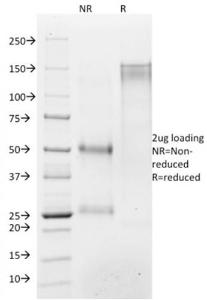 SDS-PAGE analysis of Anti-Histone H1 Antibody [AE-4] under non-reduced and reduced conditions; showing intact IgG and intact heavy and light chains, respectively. SDS-PAGE analysis confirms the integrity and purity of the antibody