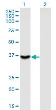 Anti-ITGB1BP2 Mouse Monoclonal Antibody [clone: 3G9]