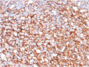 Immunohistochemical analysis of formalin-fixed, paraffin-embedded human tonsil using Anti-CD73 Antibody [NT5E/2646]