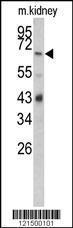 Anti-CFB Rabbit Polyclonal Antibody (Biotin)