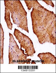 Anti-MAP3K10 Rabbit Polyclonal Antibody (HRP (Horseradish Peroxidase))