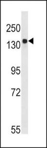 Anti-TSC2 Rabbit Polyclonal Antibody (Biotin)