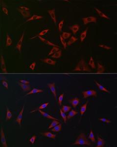 Anti-PHD2/prolyl hydroxylase antibody