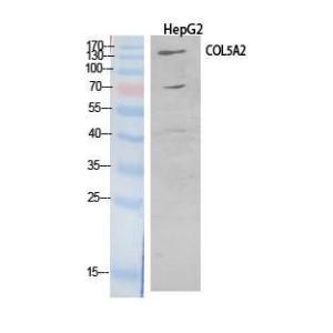 Western blot analysis of extracts from HepG2 cells using Anti-COL5A2 Antibody