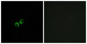 Immunofluorescence analysis of MCF7 cells using Anti-TAS1R3 Antibody The right hand panel represents a negative control, where the antibody was pre-incubated with the immunising peptide