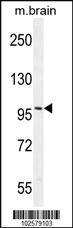 Anti-AR Rabbit Polyclonal Antibody