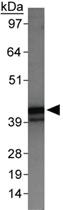 Anti-SERPINB5 Rabbit Polyclonal Antibody