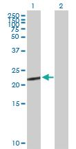 Anti-CGB5 Mouse Polyclonal Antibody