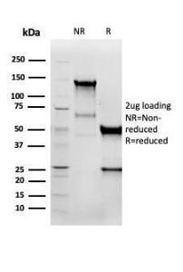 Antibody anti-cytokeratin 8 K88 100 µg