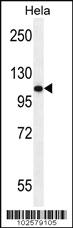 Anti-AR Rabbit Polyclonal Antibody