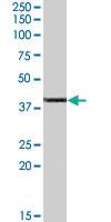 Anti-ABHD5 Goat Polyclonal Antibody