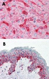 Anti-B2M Mouse Monoclonal Antibody [clone: 2213]