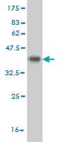 Anti-CDK8 Mouse Monoclonal Antibody [clone: 2E6]