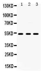 Anti-5HT2A Receptor Antibody