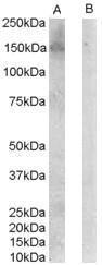 Antibody anti-ERBB 3 100 µg