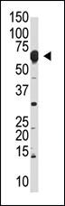 Anti-NUB1 Rabbit Polyclonal Antibody