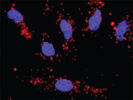 Anti-PTK2 + CCNA1 Antibody Pair