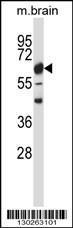 Anti-CAMK2B Rabbit Polyclonal Antibody (AP (Alkaline Phosphatase))