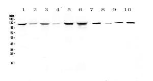 Anti-IDE Polyclonal Antibody