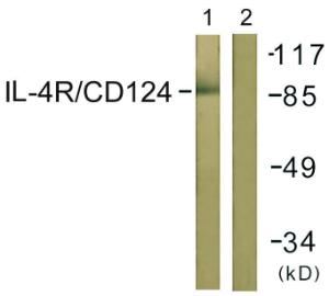 Western blot analysis of lysates from 293 cells using Anti-IL-4RAntibody. The right hand lane represents a negative control, where the antibody is blocked by the immunising peptide.