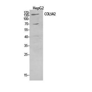 Western blot analysis of HepG2 cells using Anti-COL5A2 Antibody