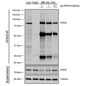 Immunoprecipitation analysis of mouse embryonic fibroblast using Anti-VPS35 Antibody [7E4] (A305036) Three amounts of A305036 (3, 1 and 03 ug) were non-covalently coupled to 10uL of A/G sepharose beads for 1 hour at 4°C and next incubated with 250ug of A549 lysate for 2 hours at 4°C