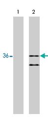 Anti-RIT2 Mouse Monoclonal Antibody [clone: 27G2]