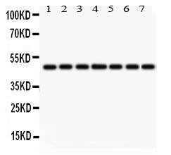 Anti-IDH1 Antibody