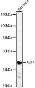 Western blot analysis of Rat brain, using Anti-FKRP Antibody (A8549) at 1:400 dilution The secondary antibody was Goat Anti-Rabbit IgG H&L Antibody (HRP) at 1:10,000 dilution Lysates/proteins were present at 25 µg per lane