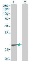 Anti-EPO Mouse Monoclonal Antibody [clone: 4G7]