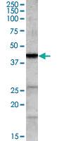 Anti-ABHD5 Goat Polyclonal Antibody