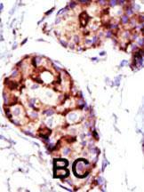 Anti-TSG101 Rabbit Polyclonal Antibody (Biotin)