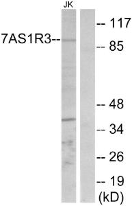 Western blot analysis of lysates from Jurkat cells using Anti-TAS1R3 Antibody The right hand lane represents a negative control, where the antibody is blocked by the immunising peptide