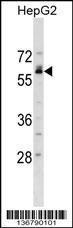 Anti-NFIB Rabbit Polyclonal Antibody (HRP (Horseradish Peroxidase))