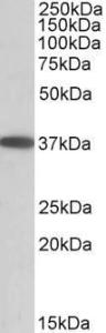 Antibody anti-MOGAT2 100 µg