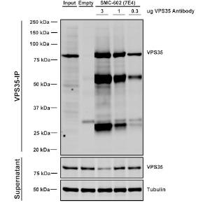 Immunoprecipitation analysis of mouse embryonic fibroblast using Anti-VPS35 Antibody [7E4] (A305036) Three amounts of A305036 (3, 1 and 03 ug) were non-covalently coupled to 10uL of A/G sepharose beads for 1 hour at 4°C and next incubated with 250ug of MEF lysate for 2 hours at 4°C