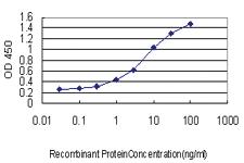 Anti-AEBP1 Mouse Monoclonal Antibody [clone: 1D2]