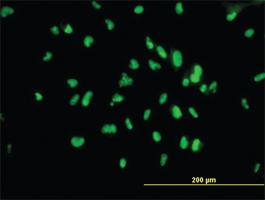 Anti-UBTF Mouse Monoclonal Antibody [clone: 1A2]