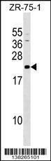 Anti-GRPEL1 Rabbit Polyclonal Antibody (PE (Phycoerythrin))