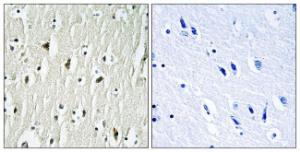 Immunohistochemical analysis of paraffin-embedded human brain tissue using Anti-CSK Antibody. The right hand panel represents a negative control, where the antibody was pre-incubated with the immunising peptide.