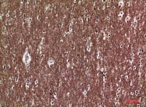 Immunohistochemical analysis of paraffin-embedded human brain using Anti-COL5A2 Antibody